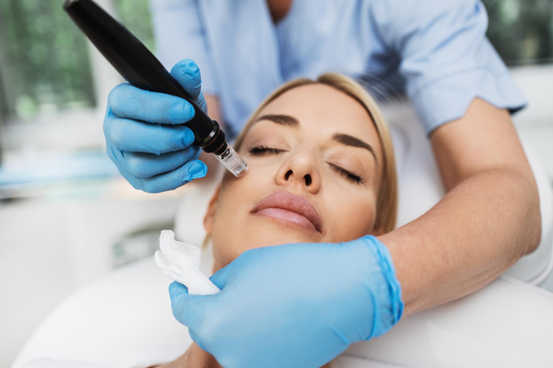 Microneedling with PRP image